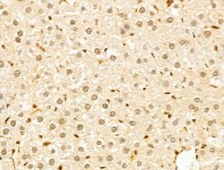 Invitrogen GABPB1 Polyclonal Antibody 100 &mu;L; Unconjugated:Antibodies,
