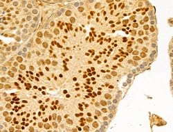 Invitrogen GABPB1 Polyclonal Antibody 100 &mu;L; Unconjugated:Antibodies,