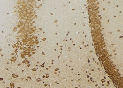 GAD65 Polyclonal Antibody 100 &mu;L | Buy Online | Thermo Scientific | Fisher Scientific