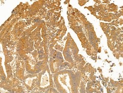 GCHFR Polyclonal Antibody:Antibodies, Polyclonal