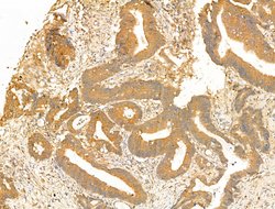 GCHFR Polyclonal Antibody:Antibodies, Polyclonal