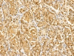 GCHFR Polyclonal Antibody:Antibodies, Polyclonal