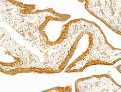 GCHFR Polyclonal Antibody:Antibodies, Polyclonal