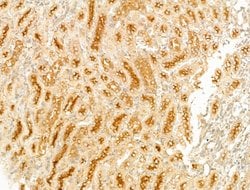 GCHFR Polyclonal Antibody:Antibodies, Polyclonal
