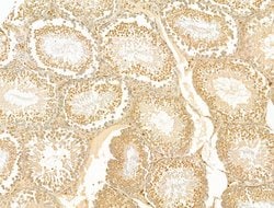 GCHFR Polyclonal Antibody:Antibodies, Polyclonal