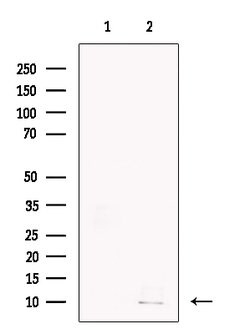GCHFR Polyclonal Antibody:Antibodies, Polyclonal