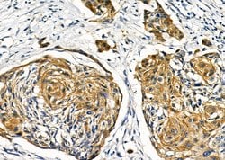 GCKR Polyclonal Antibody:Antibodies, Polyclonal