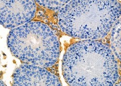 GCKR Polyclonal Antibody:Antibodies, Polyclonal