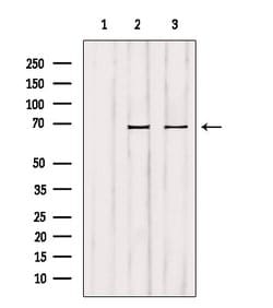 GCKR Polyclonal Antibody:Antibodies, Polyclonal