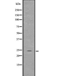 Invitrogen GDNF Polyclonal Antibody 100 &mu;L; Unconjugated:Antibodies,