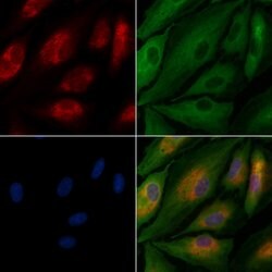 Invitrogen GFR alpha-3 Polyclonal Antibody 100 &mu;L; Unconjugated:Antibodies,