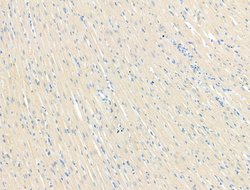 Invitrogen GFR alpha-3 Polyclonal Antibody 100 &mu;L; Unconjugated:Antibodies,
