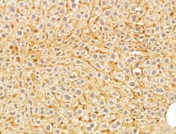 Invitrogen GGCT Polyclonal Antibody 100 &mu;L | Buy Online | Invitrogen&trade; | Fisher Scientific