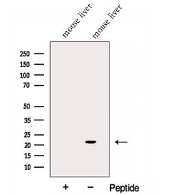 Invitrogen GGCT Polyclonal Antibody 100 &mu;L | Buy Online | Invitrogen&trade; | Fisher Scientific