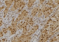 Invitrogen GLO1 Polyclonal Antibody 100 &mu;L; Unconjugated:Antibodies,