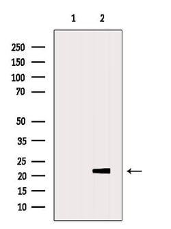 Invitrogen GLO1 Polyclonal Antibody 100 &mu;L; Unconjugated:Antibodies,