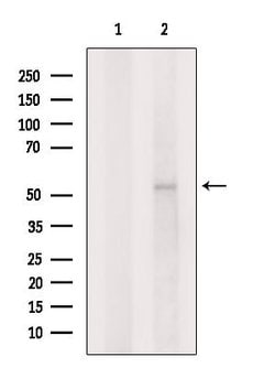Invitrogen GLRA2 Polyclonal Antibody 100 &mu;L | Buy Online | Invitrogen&trade; | Fisher Scientific