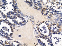 Invitrogen TXNL2 Polyclonal Antibody 100 μL; Unconjugated:Antibodies,
