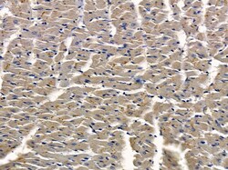Invitrogen TXNL2 Polyclonal Antibody 100 μL; Unconjugated:Antibodies,
