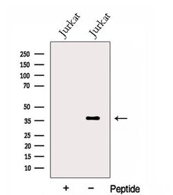 Invitrogen TXNL2 Polyclonal Antibody 100 μL; Unconjugated:Antibodies,