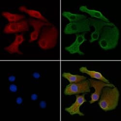 GLS2 Polyclonal Antibody:Antibodies, Polyclonal