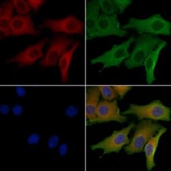 GLS2 Polyclonal Antibody:Antibodies, Polyclonal