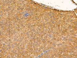 GLS2 Polyclonal Antibody:Antibodies, Polyclonal