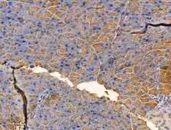 GLS2 Polyclonal Antibody:Antibodies, Polyclonal
