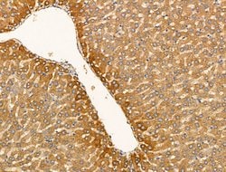 GLS2 Polyclonal Antibody:Antibodies, Polyclonal