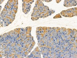 GLS2 Polyclonal Antibody:Antibodies, Polyclonal