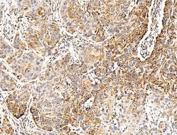 GLUT5 Polyclonal Antibody, Invitrogen 100 &mu;L; Unconjugated:Antibodies,