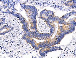 GLUT5 Polyclonal Antibody, Invitrogen 100 &mu;L; Unconjugated:Antibodies,