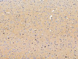 GLUT5 Polyclonal Antibody, Invitrogen 100 &mu;L; Unconjugated:Antibodies,