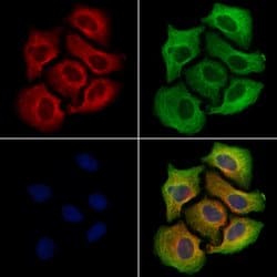 Invitrogen SLC2A12 Polyclonal Antibody 100 &mu;L | Buy Online | Invitrogen&trade; | Fisher Scientific
