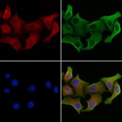 Invitrogen&trade;&nbsp;Glypican 2 Polyclonal Antibody
