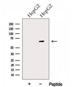 Glypican 1 Polyclonal Antibody:Antibodies, Polyclonal