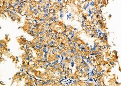 Invitrogen GNAS Polyclonal Antibody 100 &mu;L; Unconjugated:Antibodies,