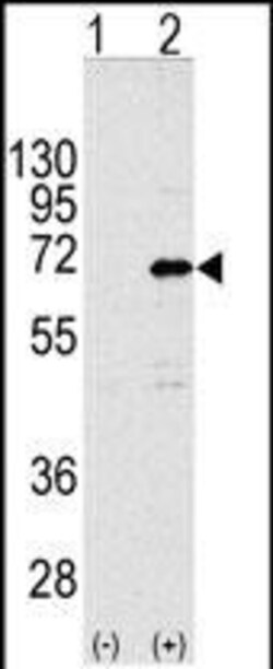 Invitrogen CNOT4 Polyclonal Antibody 400 &mu;L | Buy Online | Invitrogen&trade; | Fisher Scientific