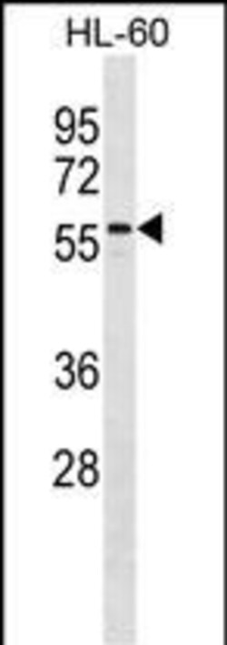 Invitrogen CNOT4 Polyclonal Antibody 400 &mu;L | Buy Online | Invitrogen&trade; | Fisher Scientific