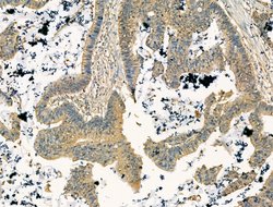 Invitrogen GOLGA4 Polyclonal Antibody 100 &mu;L; Unconjugated:Antibodies,