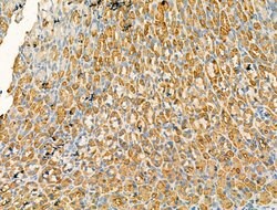 Invitrogen GOLGA4 Polyclonal Antibody 100 &mu;L; Unconjugated:Antibodies,