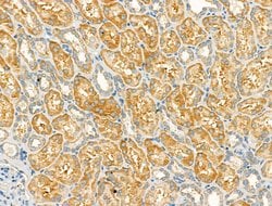 Invitrogen GOLGA4 Polyclonal Antibody 100 &mu;L; Unconjugated:Antibodies,