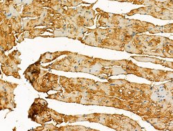 Invitrogen GOLGA4 Polyclonal Antibody 100 &mu;L; Unconjugated:Antibodies,