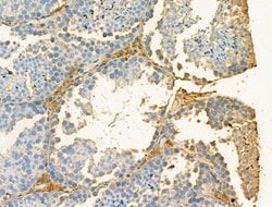 Invitrogen GOLGA4 Polyclonal Antibody 100 &mu;L; Unconjugated:Antibodies,