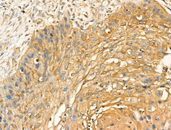 Invitrogen GOLIM4 Polyclonal Antibody 100 &mu;L; Unconjugated:Antibodies,