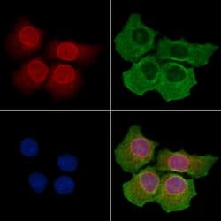Invitrogen gp210 Polyclonal Antibody 100 &mu;L; Unconjugated:Antibodies,