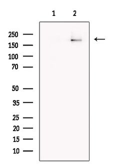 Invitrogen gp210 Polyclonal Antibody 100 &mu;L; Unconjugated:Antibodies,