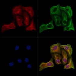 Invitrogen GPAT2 Polyclonal Antibody 100 &mu;L; Unconjugated:Antibodies,