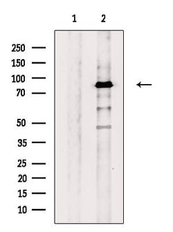 Invitrogen GPAT2 Polyclonal Antibody 100 &mu;L; Unconjugated:Antibodies,