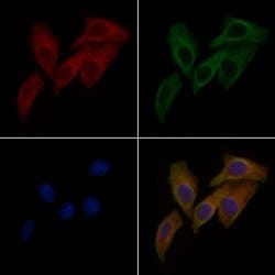 Invitrogen TEM5 Polyclonal Antibody 100 &mu;L; Unconjugated:Antibodies,